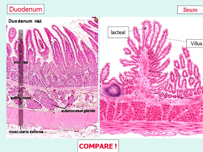 Ileum Duodenum Villus lacteal COMPARE !